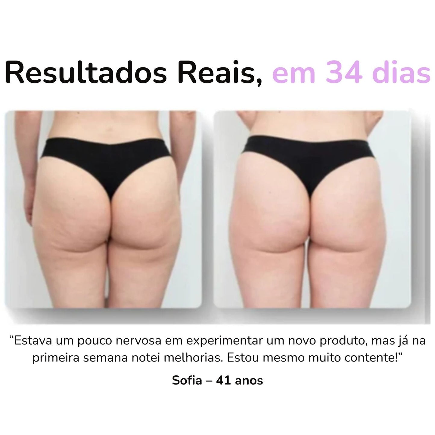 SheVitality™ Tratamento Profissional anticelulite