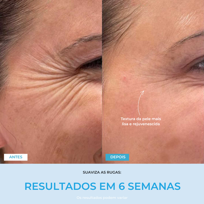 Liftlab — Modelador Facial Rejuvenescedor com Sérum Grátis