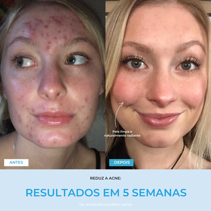 Liftlab — Modelador Facial Rejuvenescedor com Sérum Grátis
