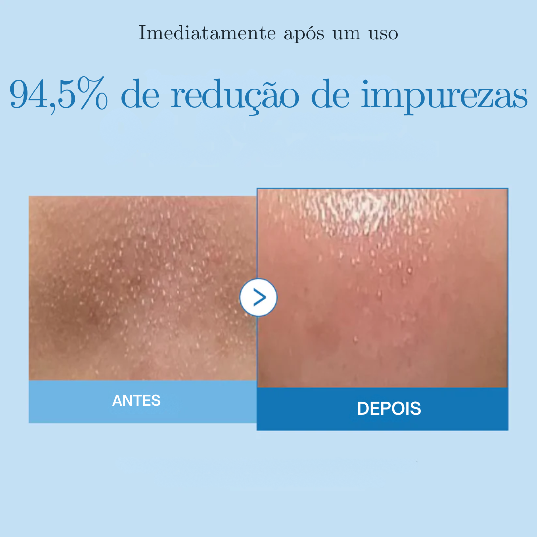 Óleo de Limpeza Profunda Zero Pore Blackhead