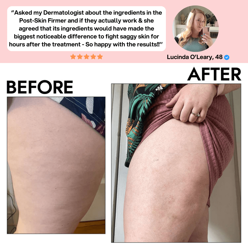 3 Unidades Sérum Escultor Firm & Lift