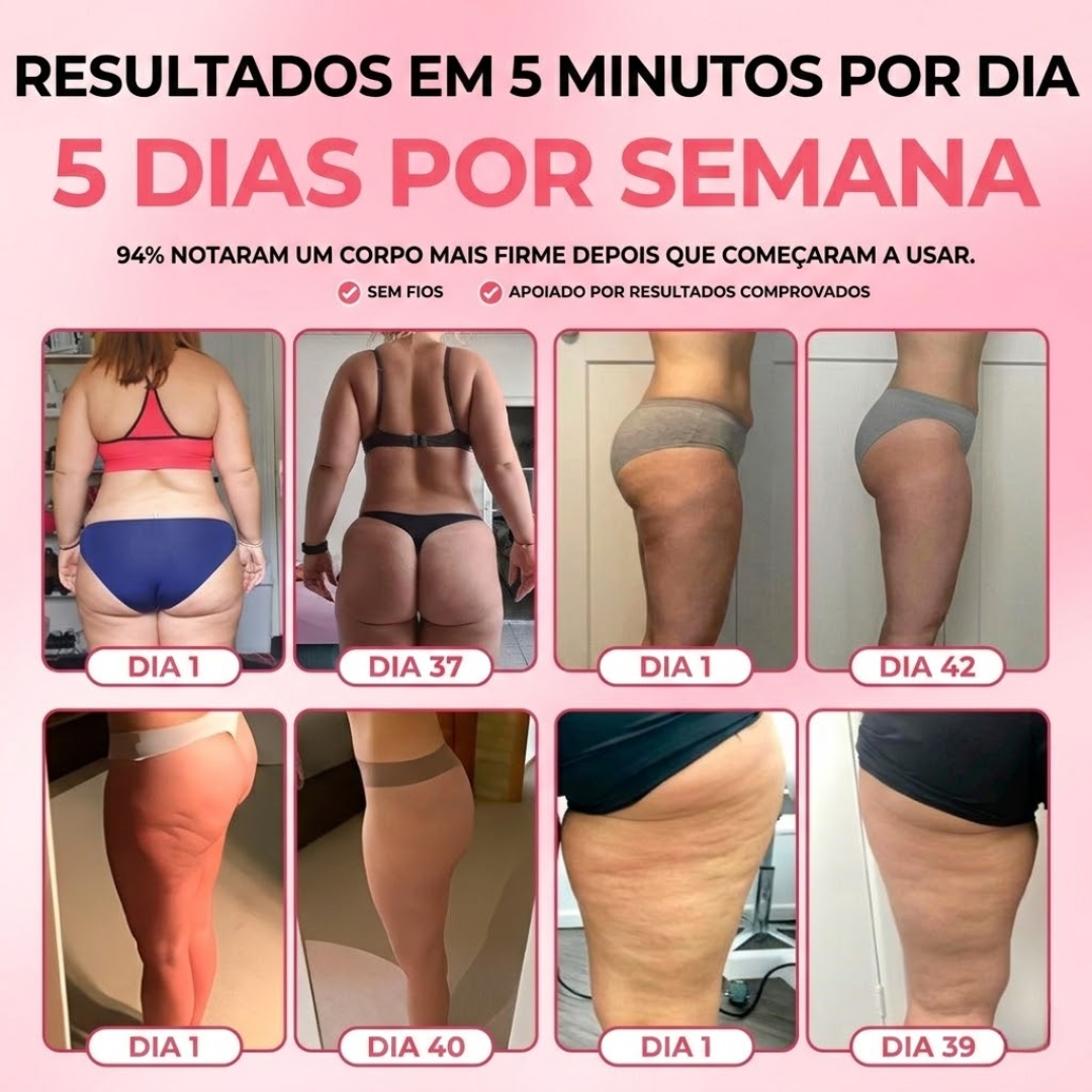SheVitality™ Tratamento Profissional anticelulite