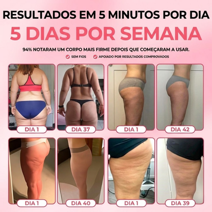 SheVitality™ Tratamento Profissional anticelulite