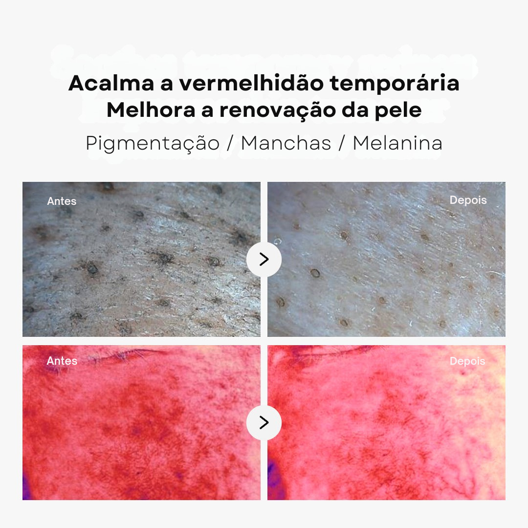 Discos de Ácido Succínico com Pantenol