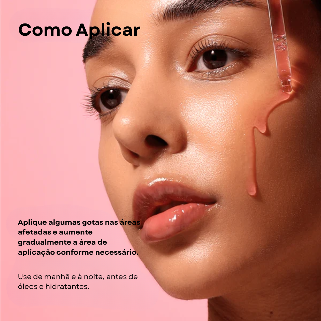 Sérum Niacinamida 10% + TXA 4%