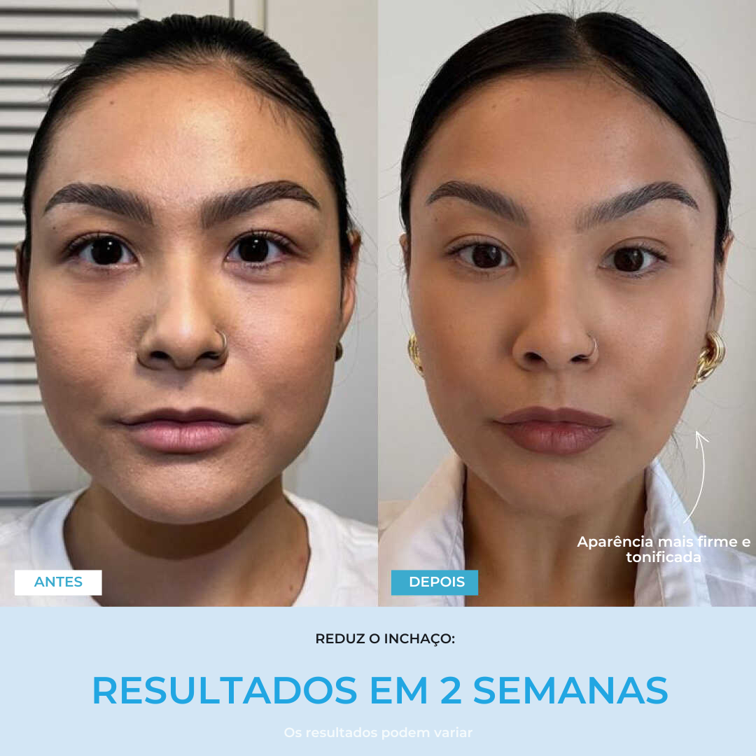 Liftlab — Modelador Facial Rejuvenescedor com Sérum Grátis