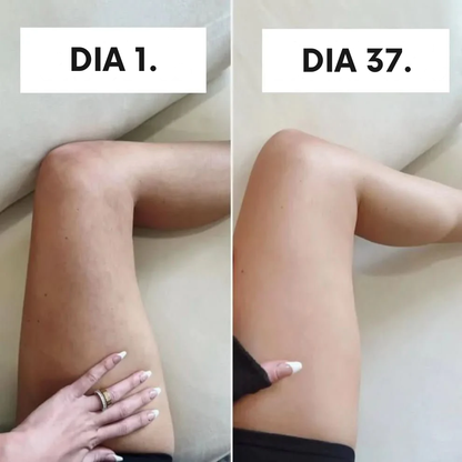 SheVitality™ Tratamento Profissional anticelulite