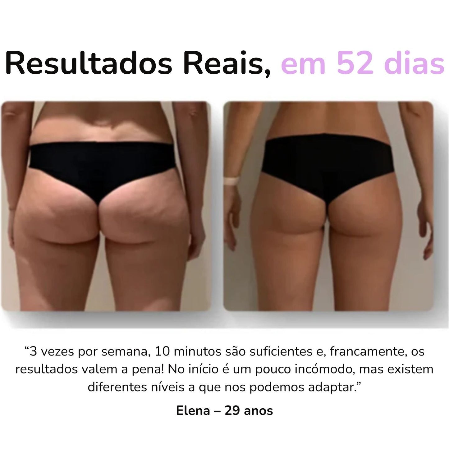SheVitality™ Tratamento Profissional anticelulite