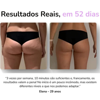 SheVitality™ Tratamento Profissional anticelulite